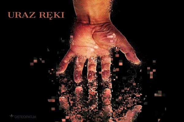 Uraz ręki