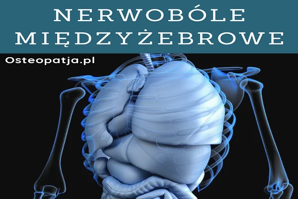 Bóle między żebrowe