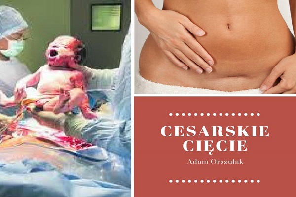 Cesarskie cięcie