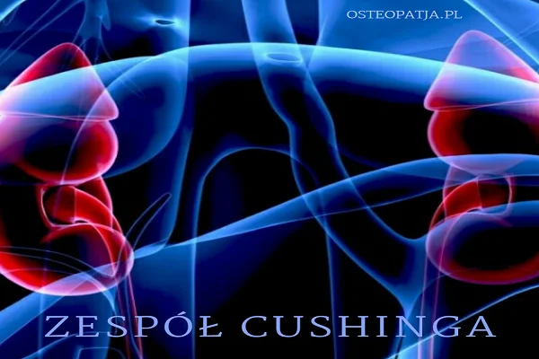 Zespół Cushinga