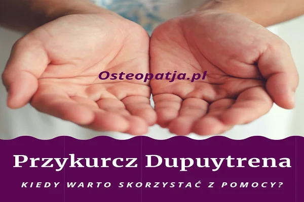 Przykurcz Dupuytrena
