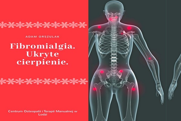 Fibromialgia Łódź