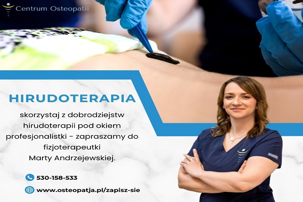 Hirudoterapia - leczenie pijawkami. Hirudoterapia - leczenie pijawkami.