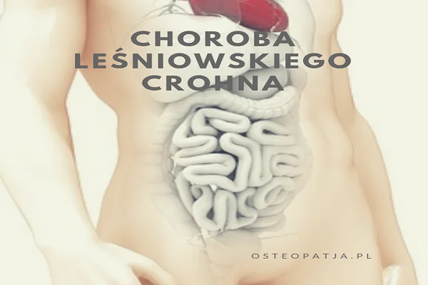Choroba Leśniowskiego – Crohna Choroba Leśniowskiego – Crohna