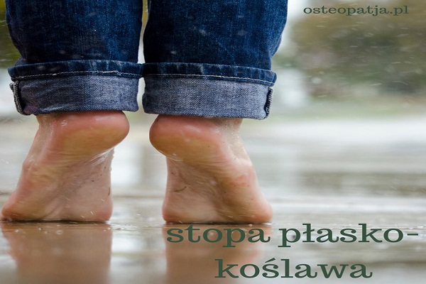 Stopa płasko-koślawa