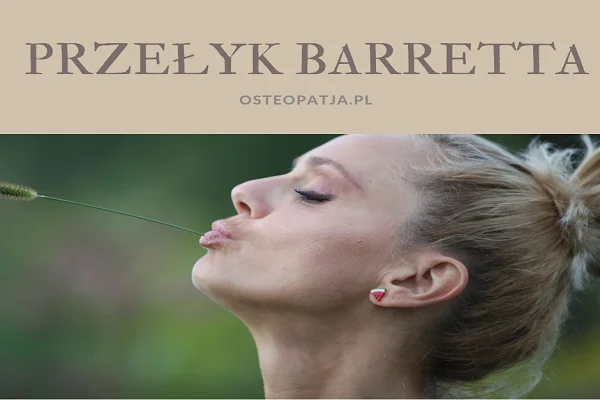 Przełyk Barretta Przełyk Barretta