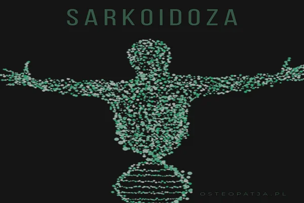 Sarkoidoza