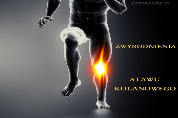 Zmiany zwyrodnieniowe stawu kolanowego