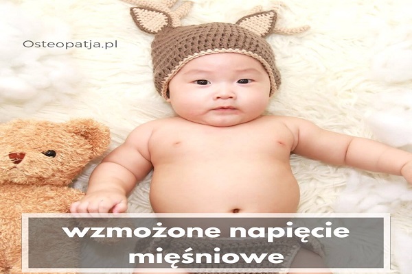 Wzmożone napięcie mięśniowe